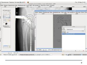 Использование СПО в планировании ортопедических оперативных вмешательств (Анатолий Якушин, OSSDEVCONF-2025).pdf