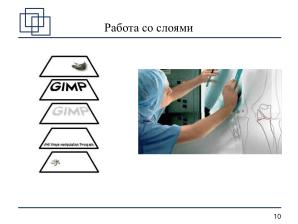 Использование СПО в планировании ортопедических оперативных вмешательств (Анатолий Якушин, OSSDEVCONF-2025).pdf