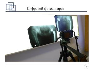 Использование СПО в планировании ортопедических оперативных вмешательств (Анатолий Якушин, OSSDEVCONF-2025).pdf