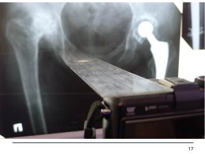 Использование СПО в планировании ортопедических оперативных вмешательств (Анатолий Якушин, OSSDEVCONF-2025).pdf